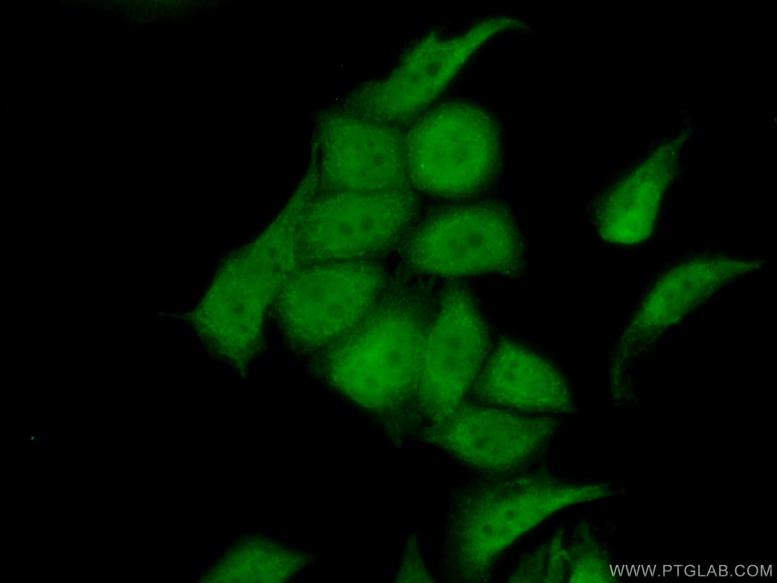 IF Staining of PC-3 using 20156-1-AP