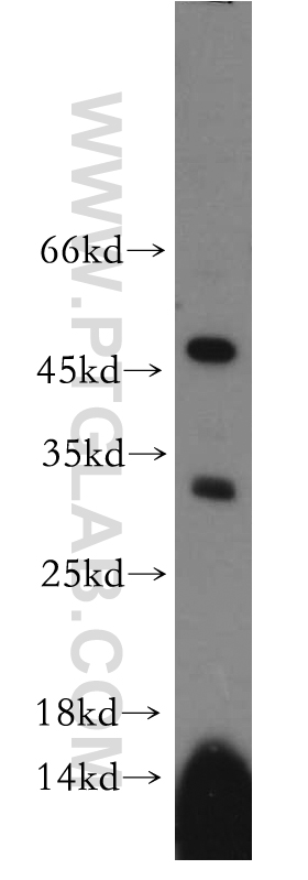 WB analysis of PC-3 using 20156-1-AP