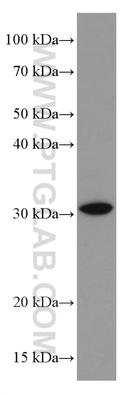 WB analysis of PC-3 using 66941-1-Ig