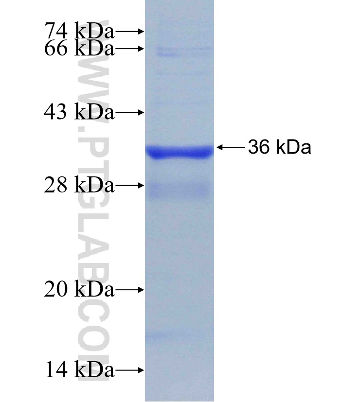 RDM1 fusion protein Ag31134 SDS-PAGE RDM1 fusion protein Ag31134 SDS-PAGE