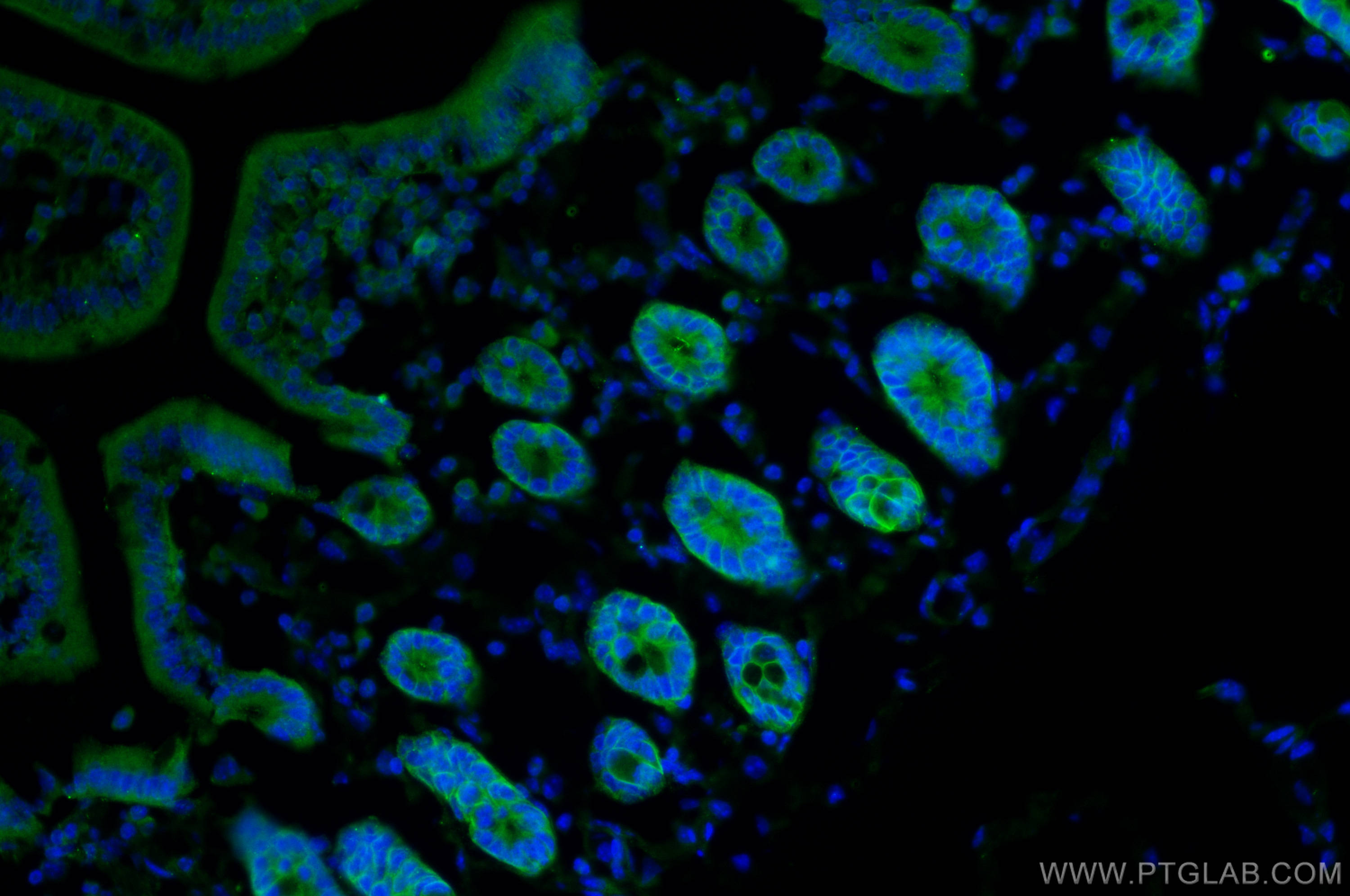 IF Staining of mouse small intestine using 20350-1-AP