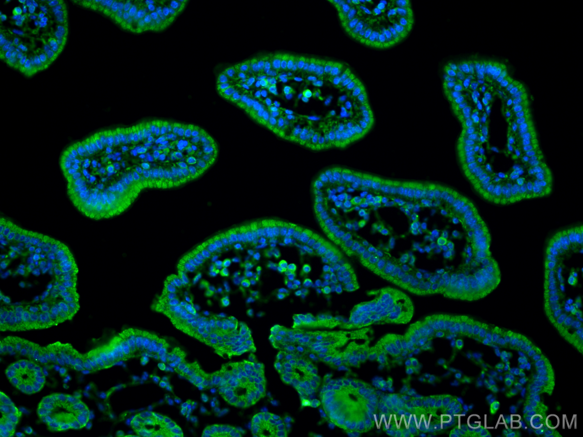 IF Staining of mouse small intestine using 68540-1-Ig