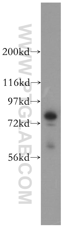 WB analysis of mouse pancreas using 13790-1-AP