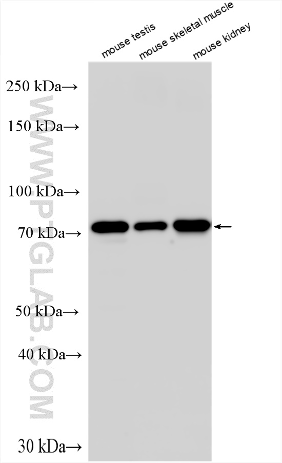 WB analysis using 14940-1-AP