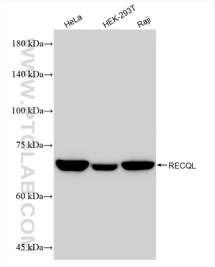 WB analysis using 85024-5-RR