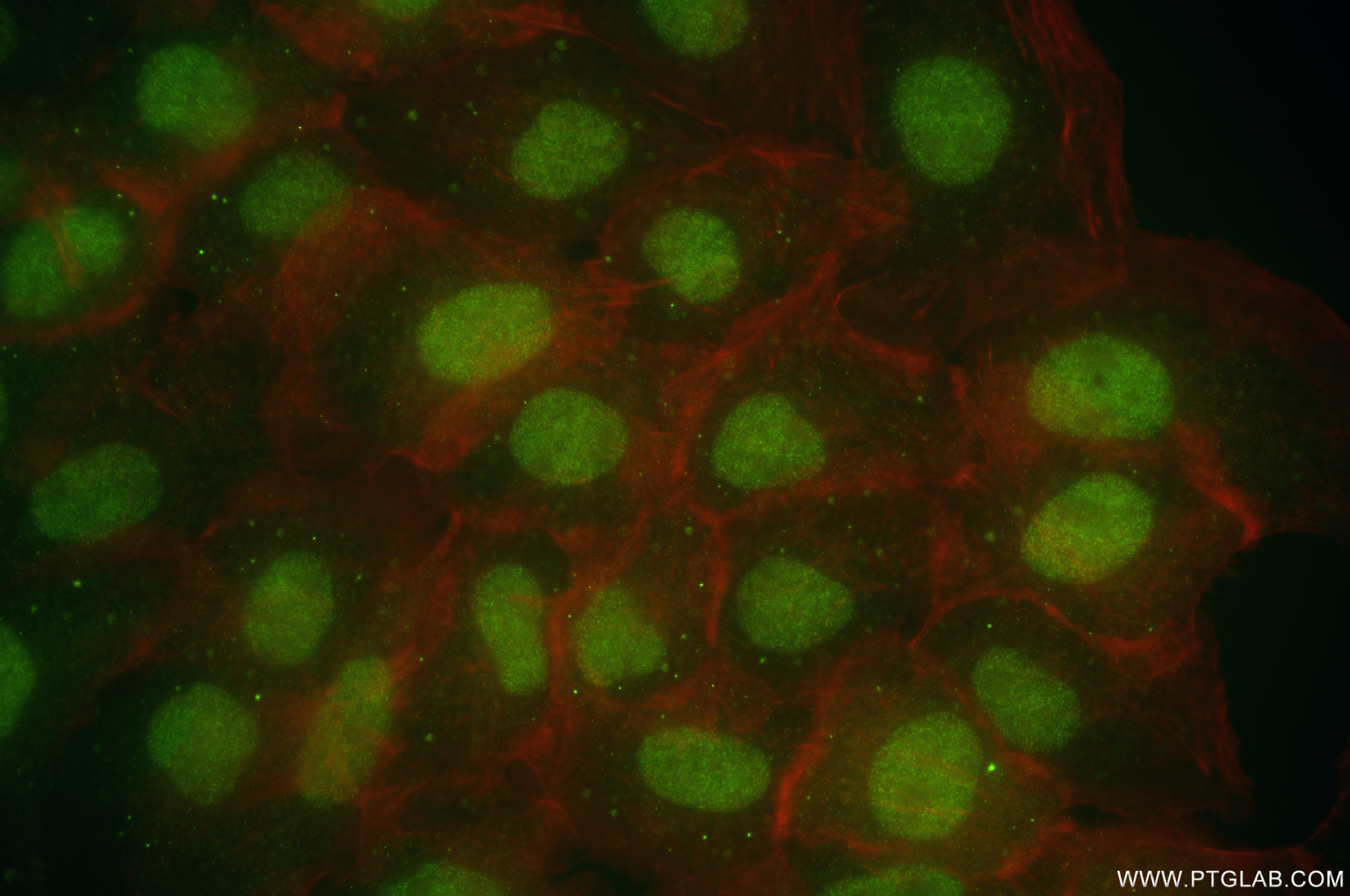 IF Staining of A431 using 86529-2-RR (same clone as 86529-2-PBS)
