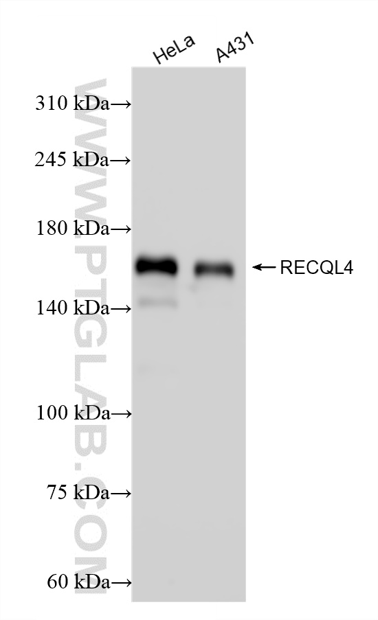 WB analysis using 86529-2-RR (same clone as 86529-2-PBS)