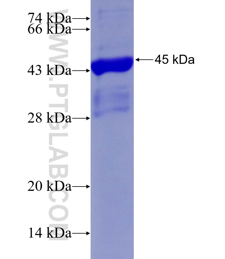 RECQL4 fusion protein Ag28742 SDS-PAGE