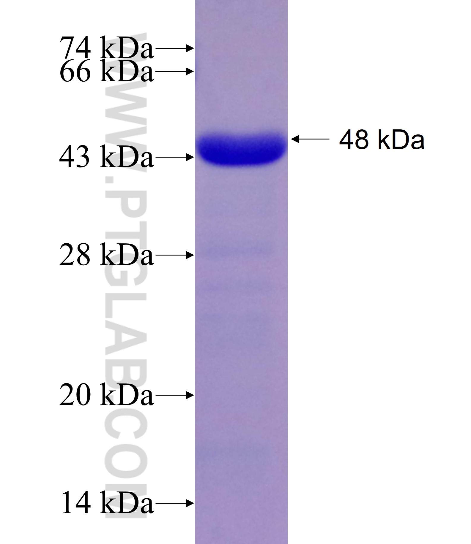 RECQL4 fusion protein Ag10933 SDS-PAGE RECQL4 fusion protein Ag10933 SDS-PAGE