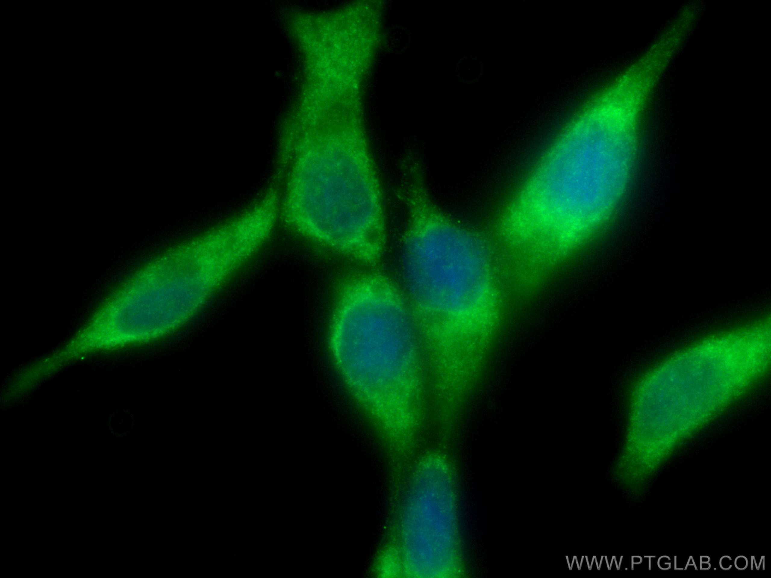 IF Staining of LNCaP using 10638-1-AP