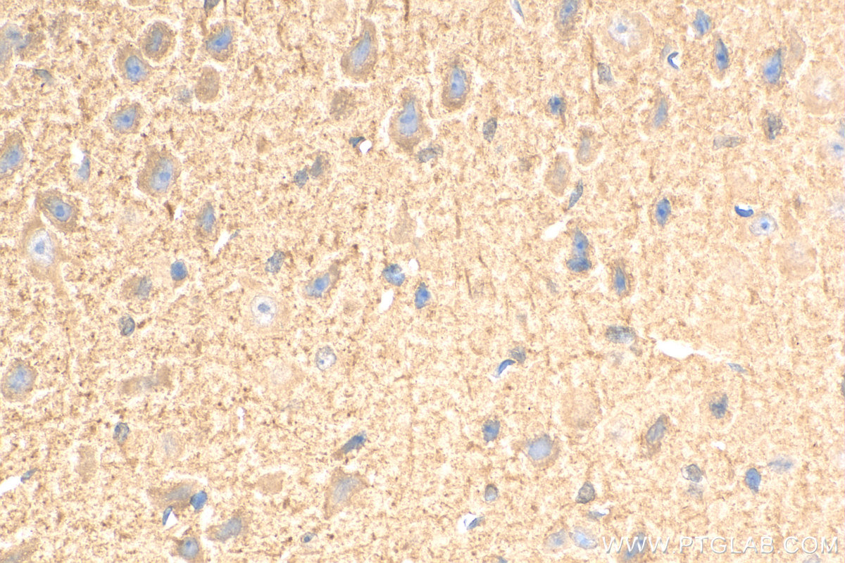 IHC staining of mouse brain using 10638-1-AP