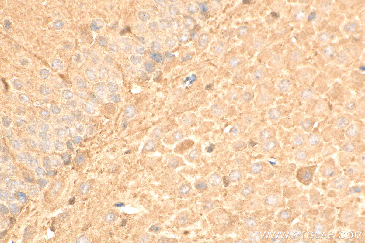 IHC staining of mouse brain using 10638-1-AP