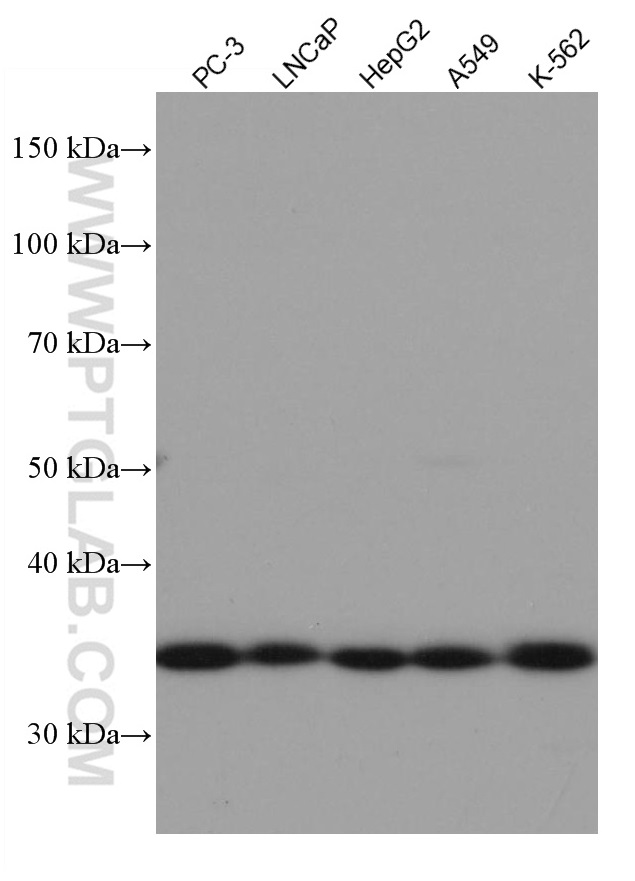 WB analysis using 67059-1-Ig (same clone as 67059-1-PBS)