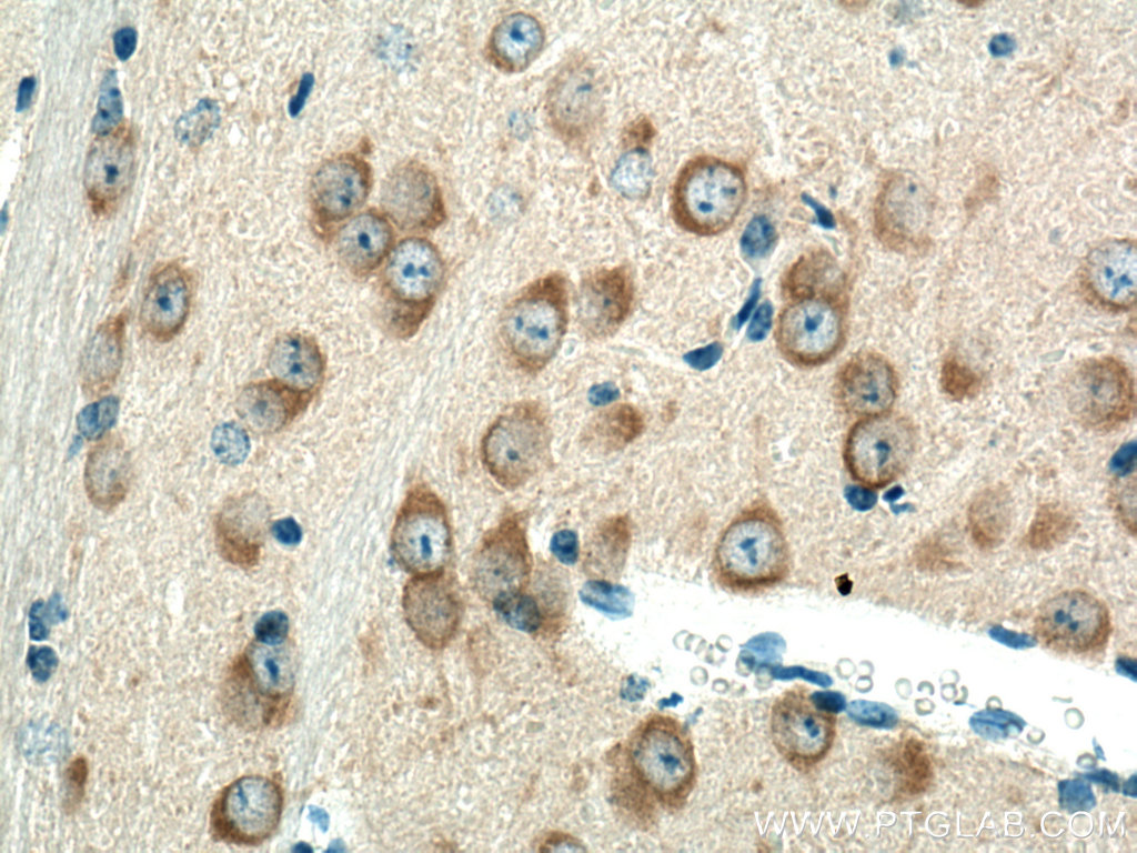 IHC staining of mouse brain using 17988-1-AP