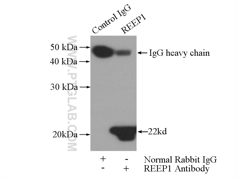 IP experiment of mouse brain using 17988-1-AP