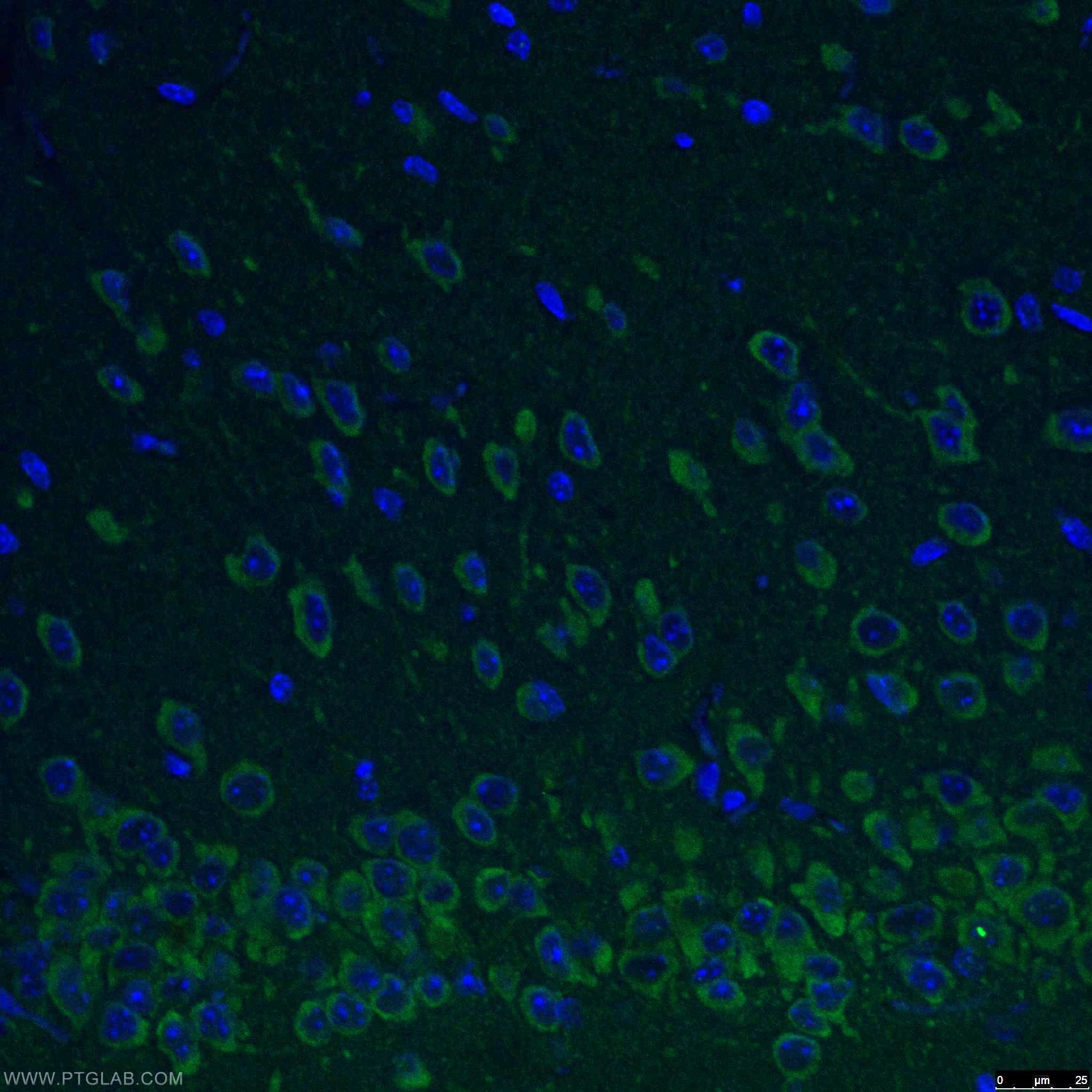 IF Staining of mouse brain using 15684-1-AP