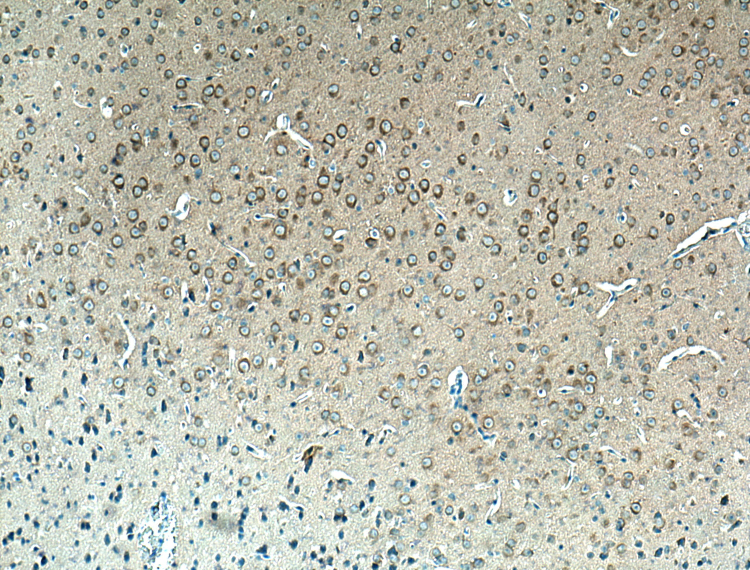 IHC staining of mouse brain using 15684-1-AP