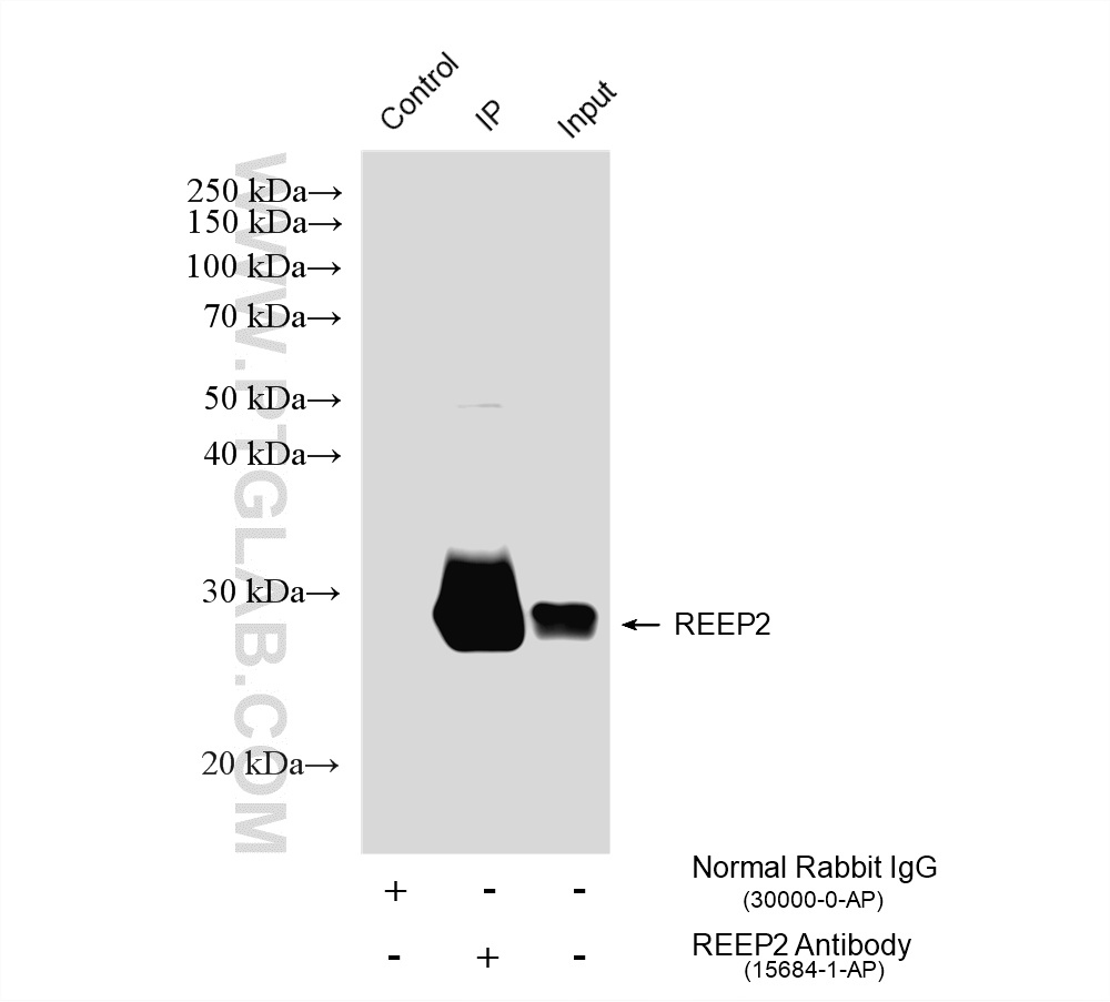 IP experiment of mouse brain using 15684-1-AP IP experiment of mouse brain using 15684-1-AP