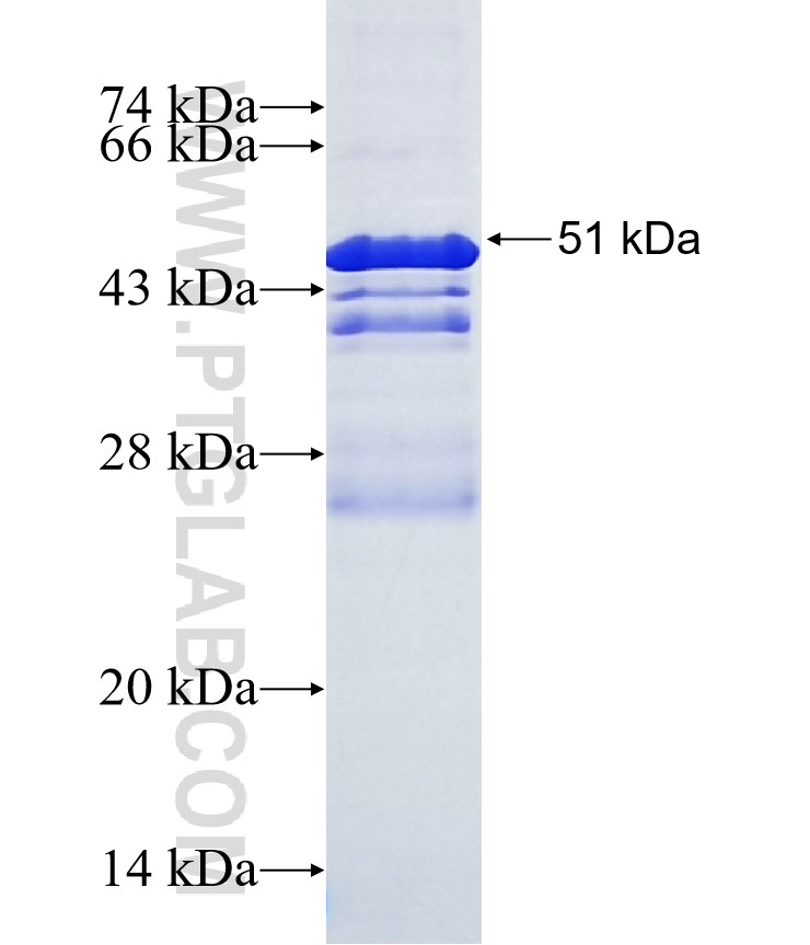 REEP3 fusion protein Ag18312 SDS-PAGE REEP3 fusion protein Ag18312 SDS-PAGE