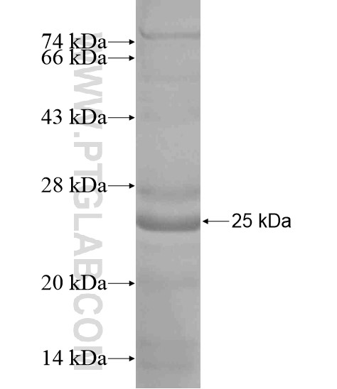 REEP3 fusion protein Ag19400 SDS-PAGE REEP3 fusion protein Ag19400 SDS-PAGE
