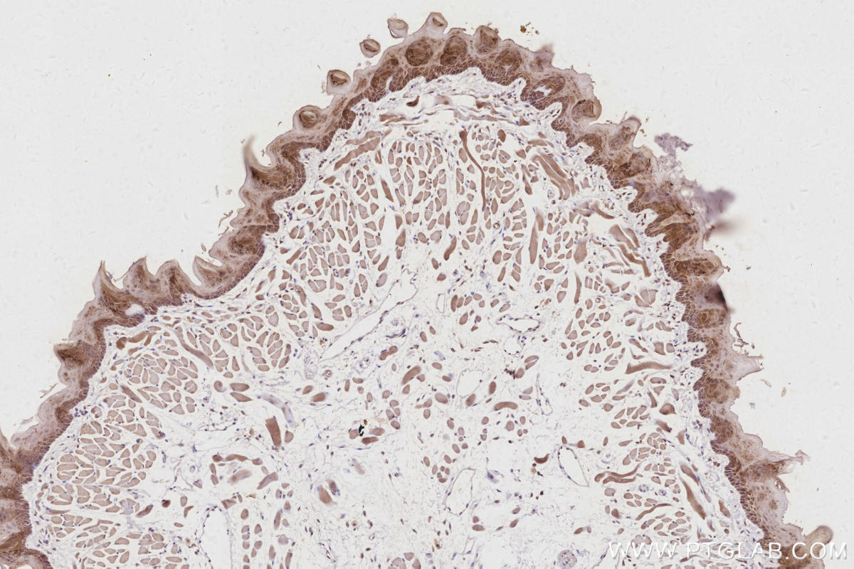 IHC staining of mouse tongue using 26650-1-AP IHC staining of mouse tongue using 26650-1-AP