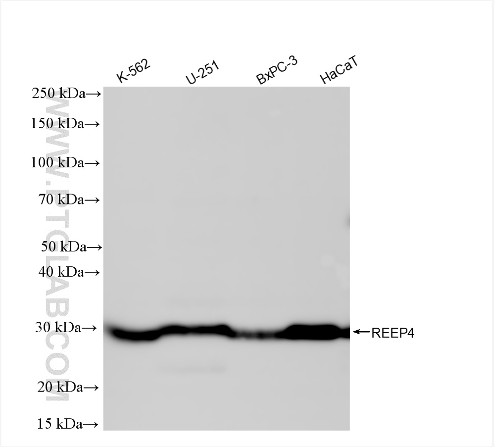 WB analysis using 86164-2-RR (same clone as 86164-2-PBS)