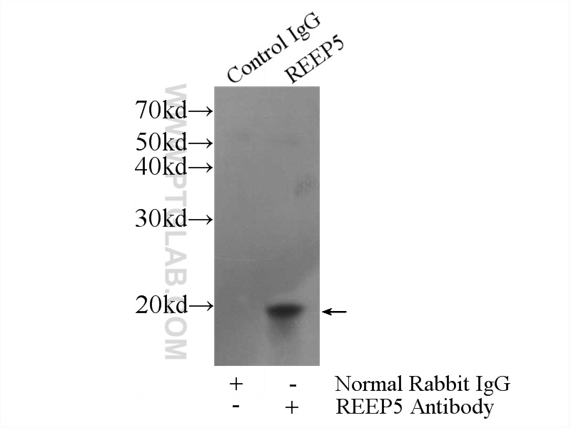 IP experiment of HeLa using 14643-1-AP