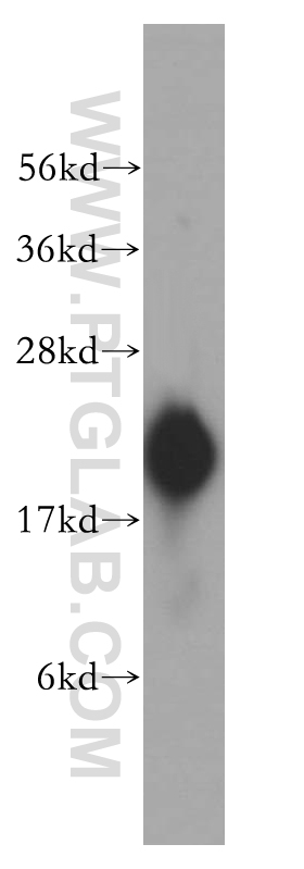 REEP5 Polyclonal antibody