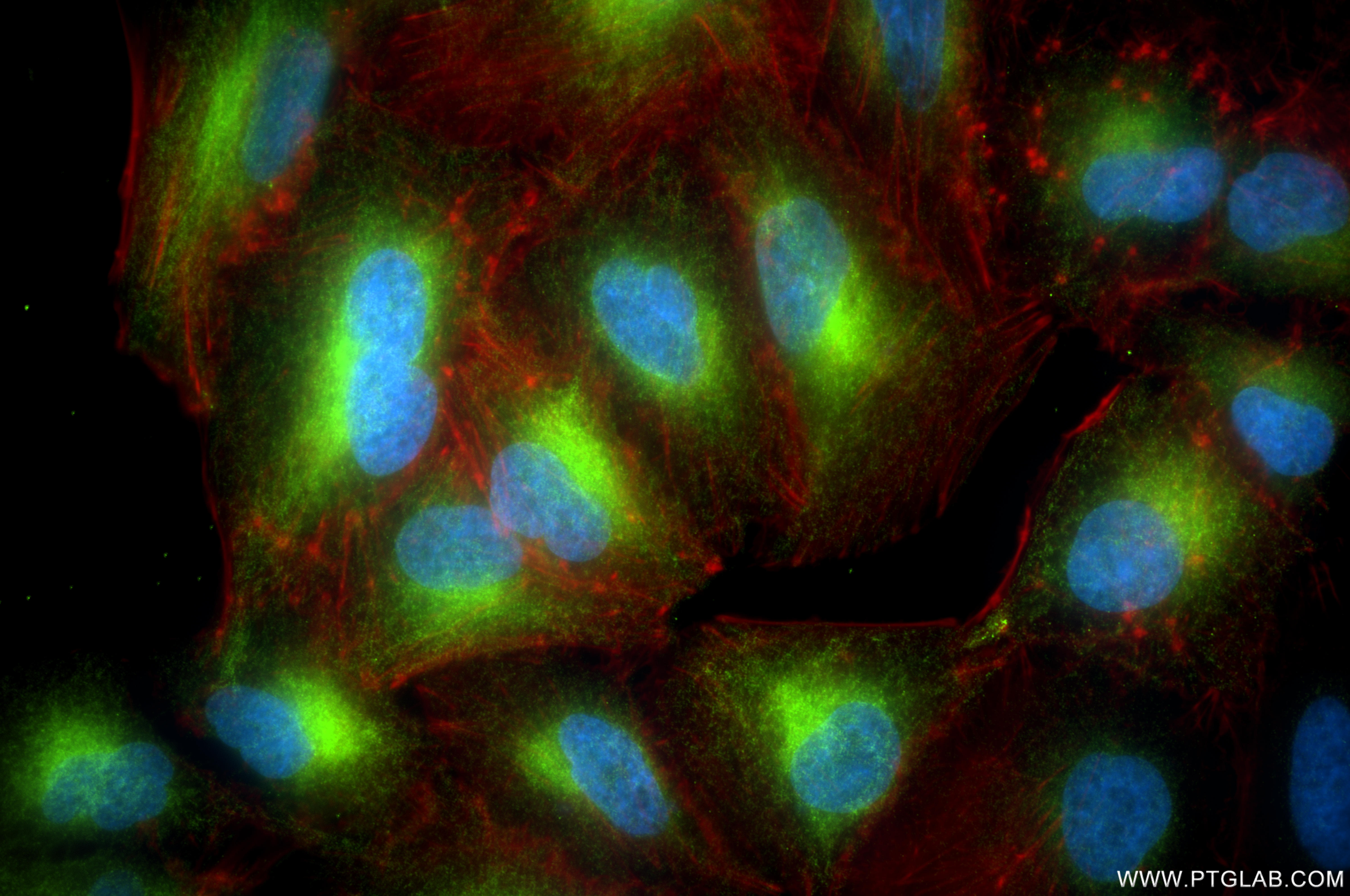 IF Staining of A549 using 86849-1-RR IF Staining of A549 using 86849-1-RR