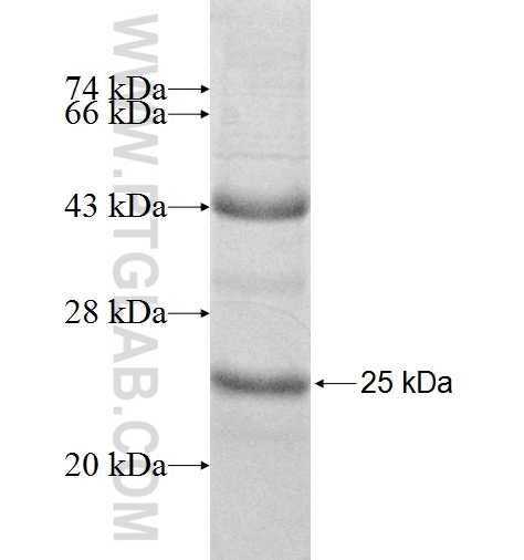 REG fusion protein Ag8569 SDS-PAGE REG fusion protein Ag8569 SDS-PAGE