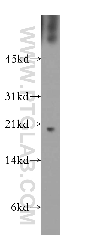 WB analysis of PC-3 using 13519-1-AP