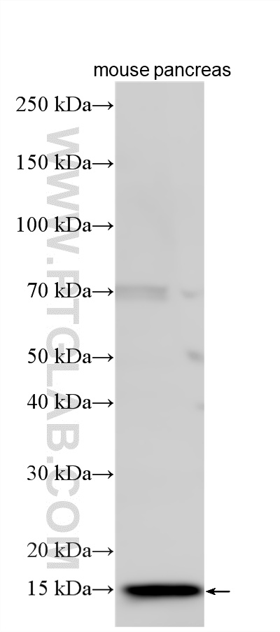 Various lysates were subjected to SDS PAGE followed by western blot with 33895-1-AP (REG3G antibody) at dilution of 1:1000 incubated at room temperature for 1.5 hours. WB analysis using 33895-1-AP