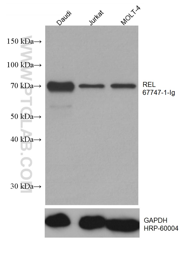 WB analysis using 67747-1-Ig