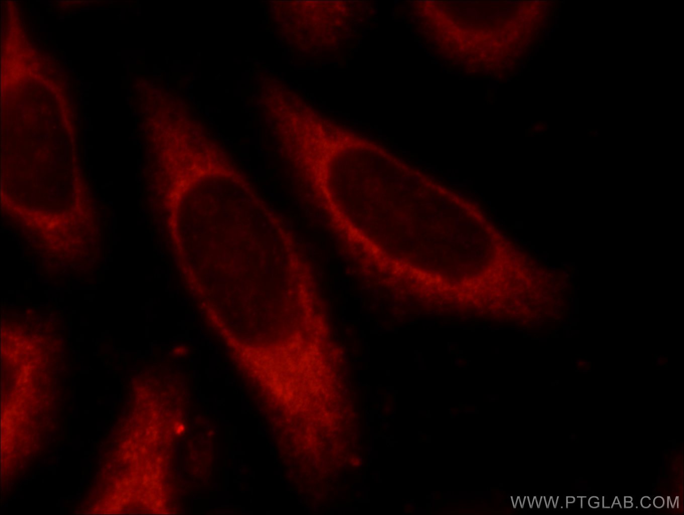IF Staining of HeLa using 25027-1-AP