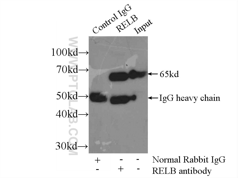 IP experiment of Raji using 25027-1-AP