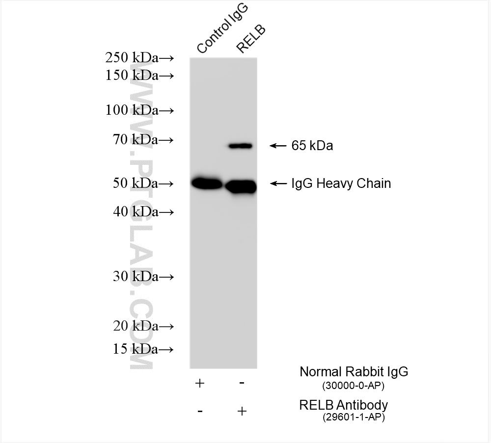 IP experiment of Raji using 29601-1-AP