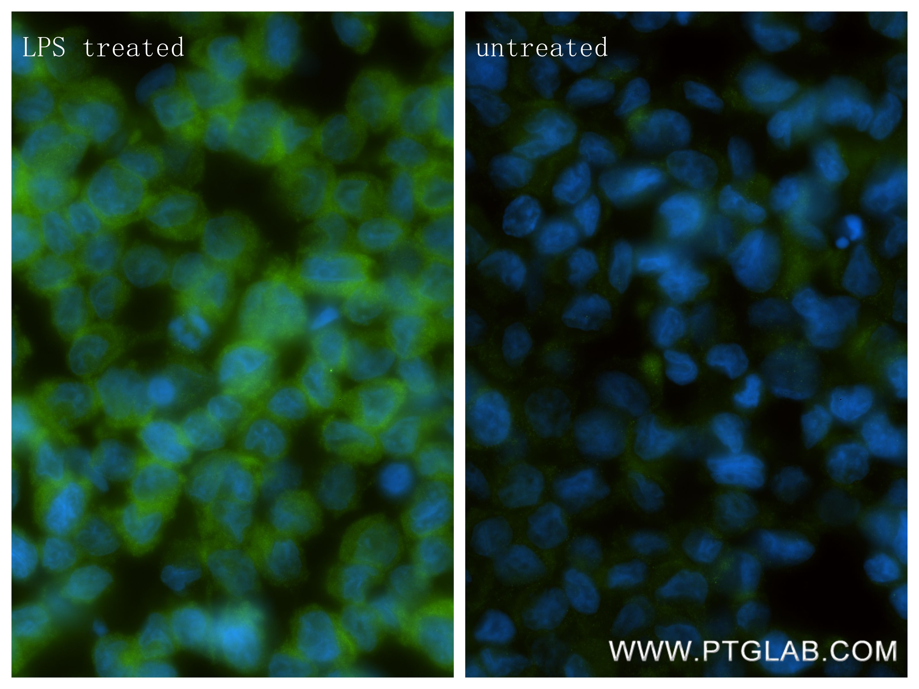 IF Staining of THP-1 using 83305-6-RR IF Staining of THP-1 using 83305-6-RR