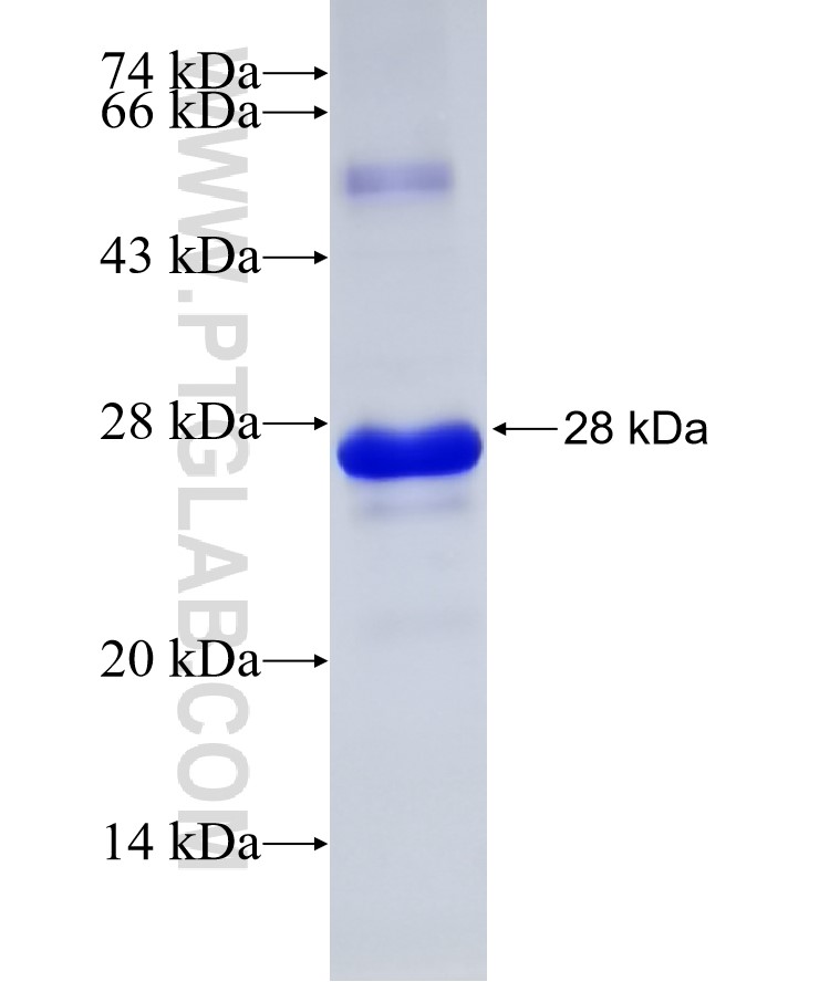 RELL1 fusion protein Ag31489 SDS-PAGE