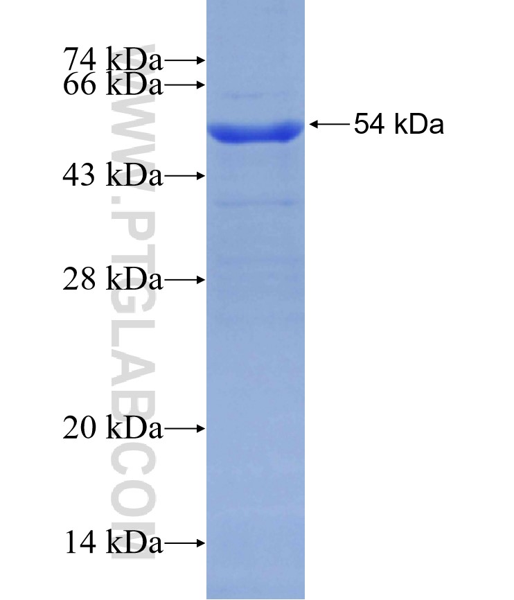 RELN fusion protein Ag29430 SDS-PAGE