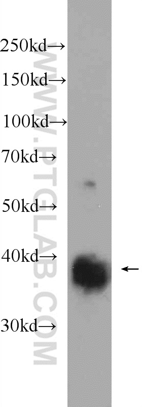 WB analysis of fetal human brain using 25371-1-AP
