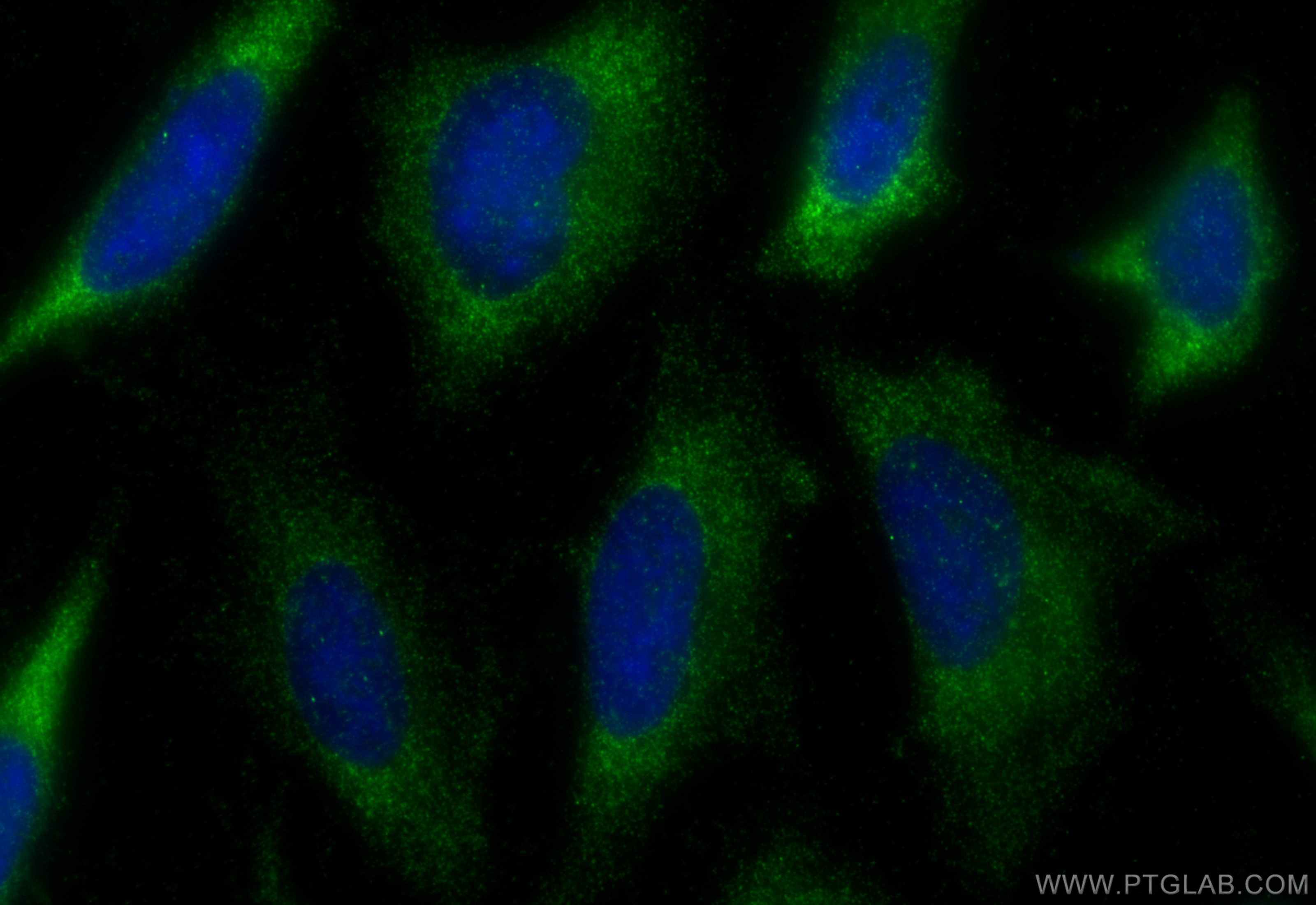 IF Staining of HeLa using 14291-1-AP