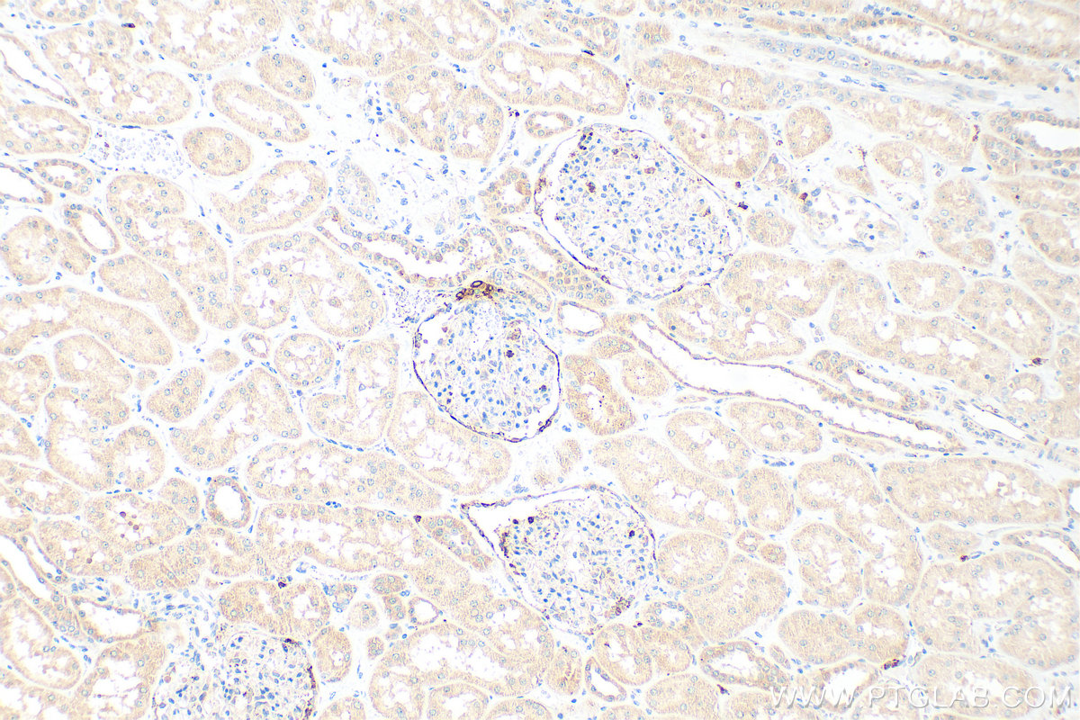 IHC staining of human kidney using 14291-1-AP