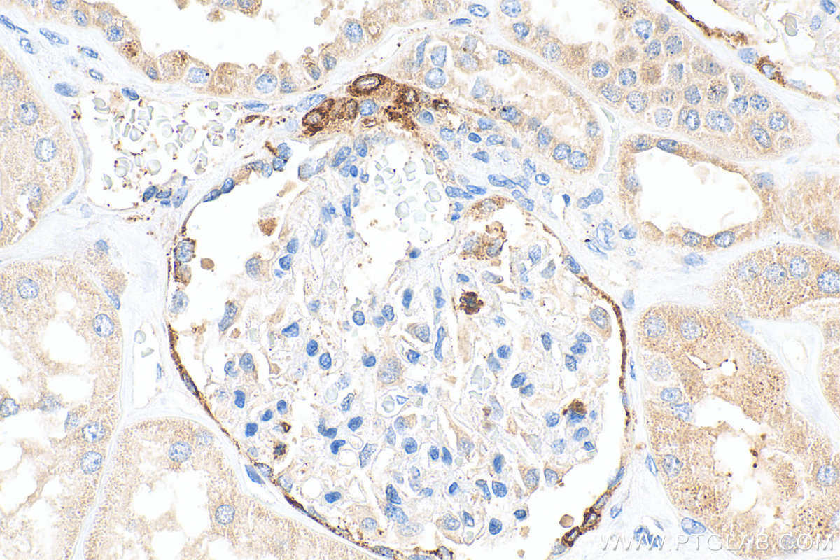 IHC staining of human kidney using 14291-1-AP
