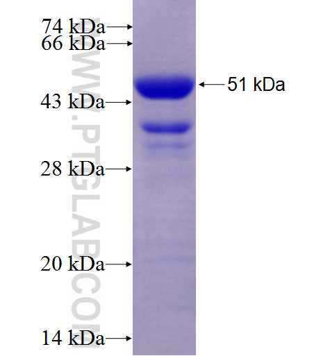 REN fusion protein Ag6173 SDS-PAGE REN fusion protein Ag6173 SDS-PAGE