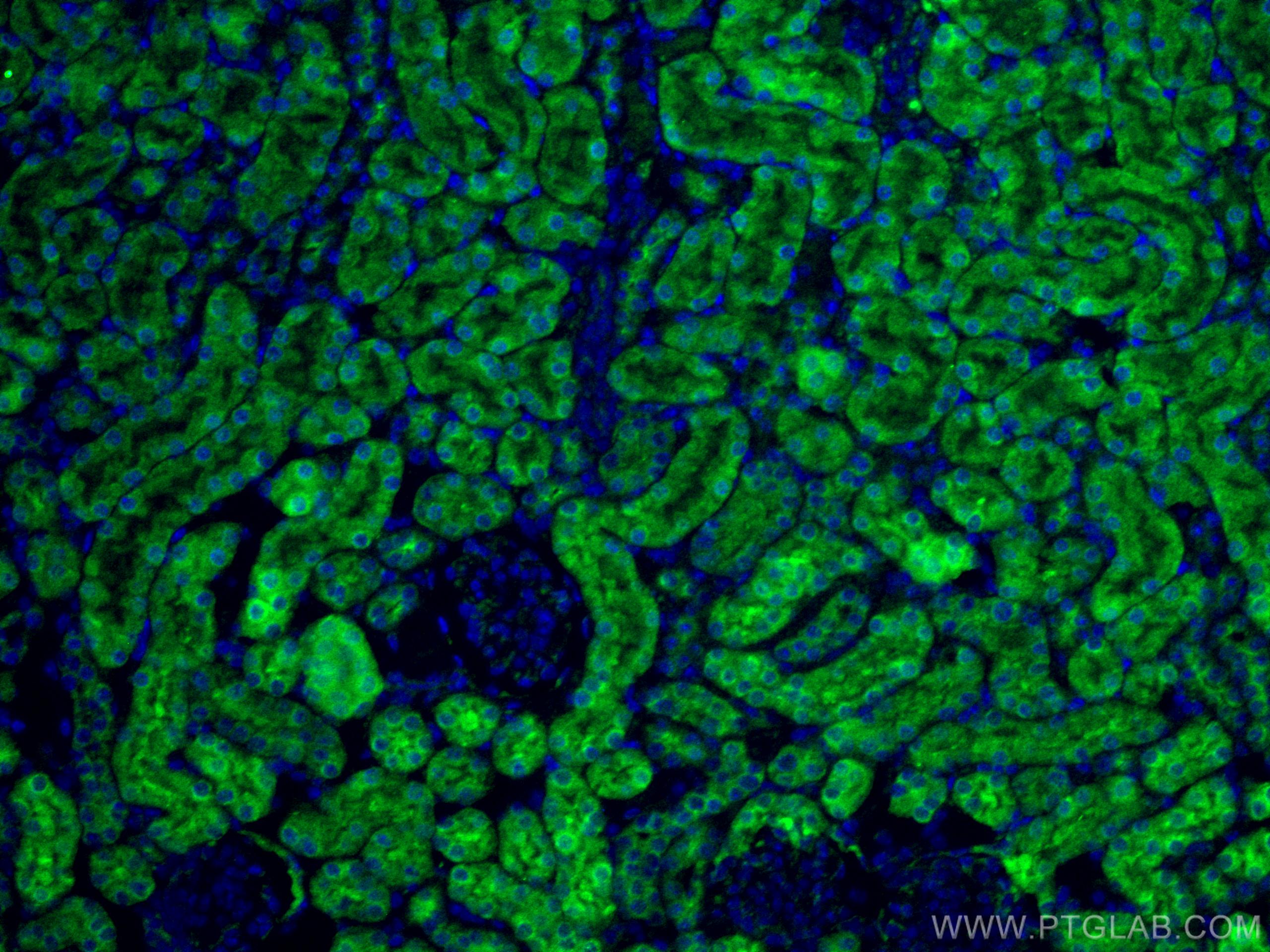 IF Staining of mouse kidney using 15003-1-AP