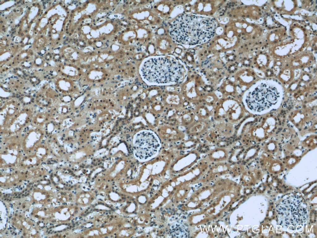 IHC staining of human kidney using 60128-1-Ig