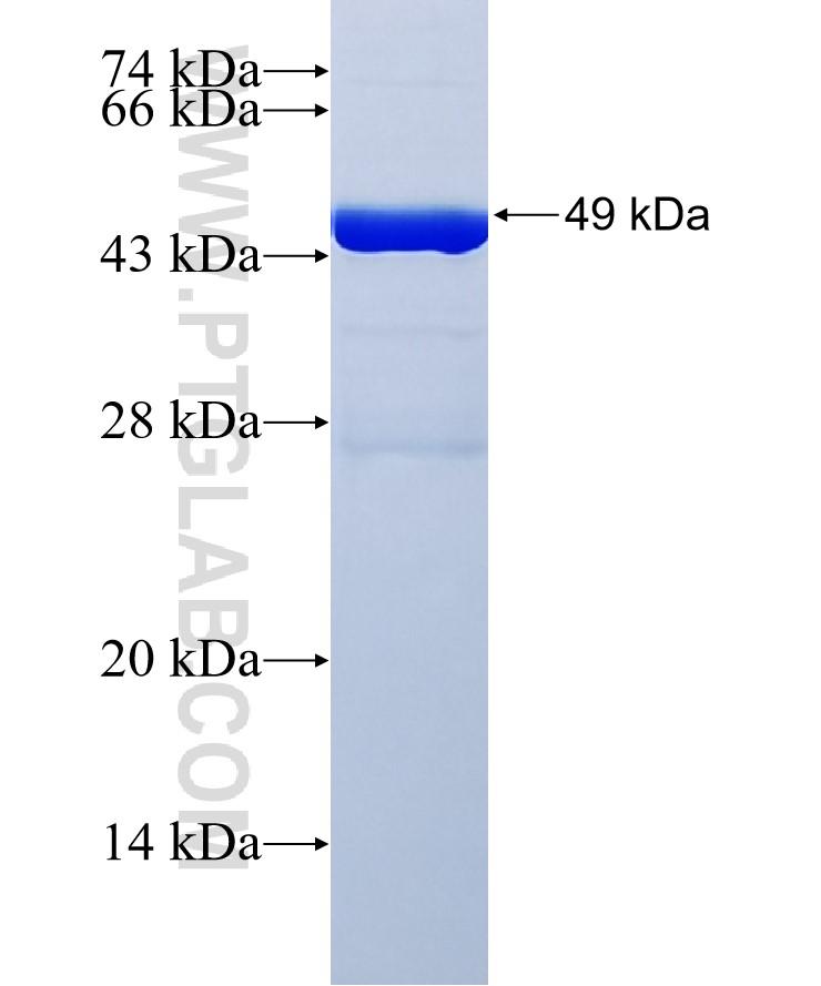 RENALASE fusion protein Ag32650 SDS-PAGE RENALASE fusion protein Ag32650 SDS-PAGE