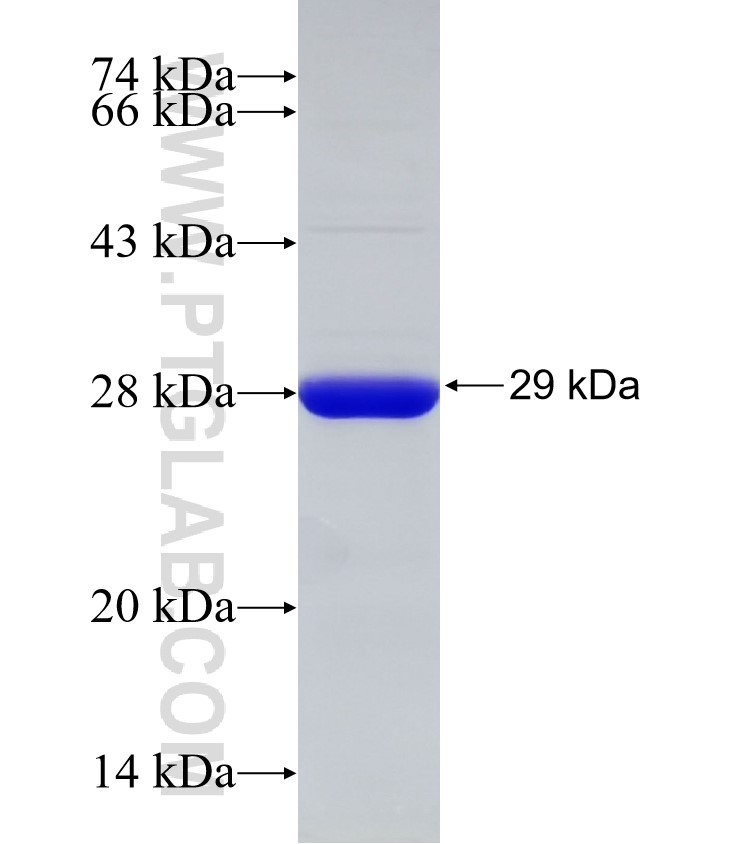 RENALASE fusion protein Ag32675 SDS-PAGE RENALASE fusion protein Ag32675 SDS-PAGE