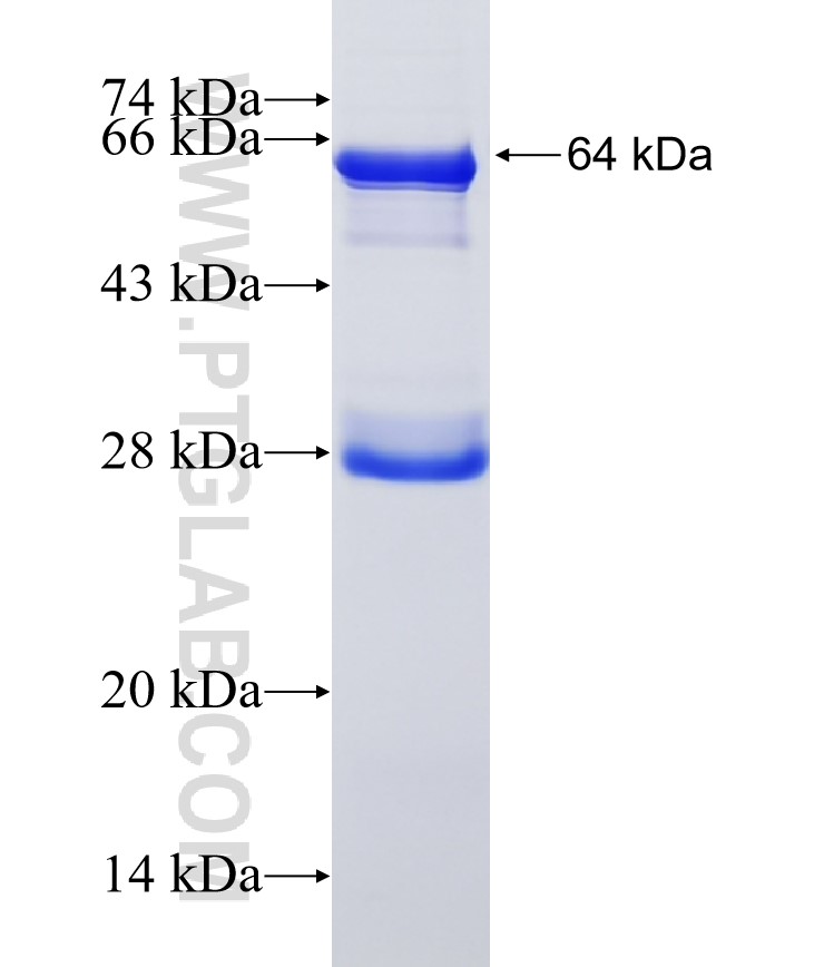 RENALASE fusion protein Ag0508 SDS-PAGE RENALASE fusion protein Ag0508 SDS-PAGE