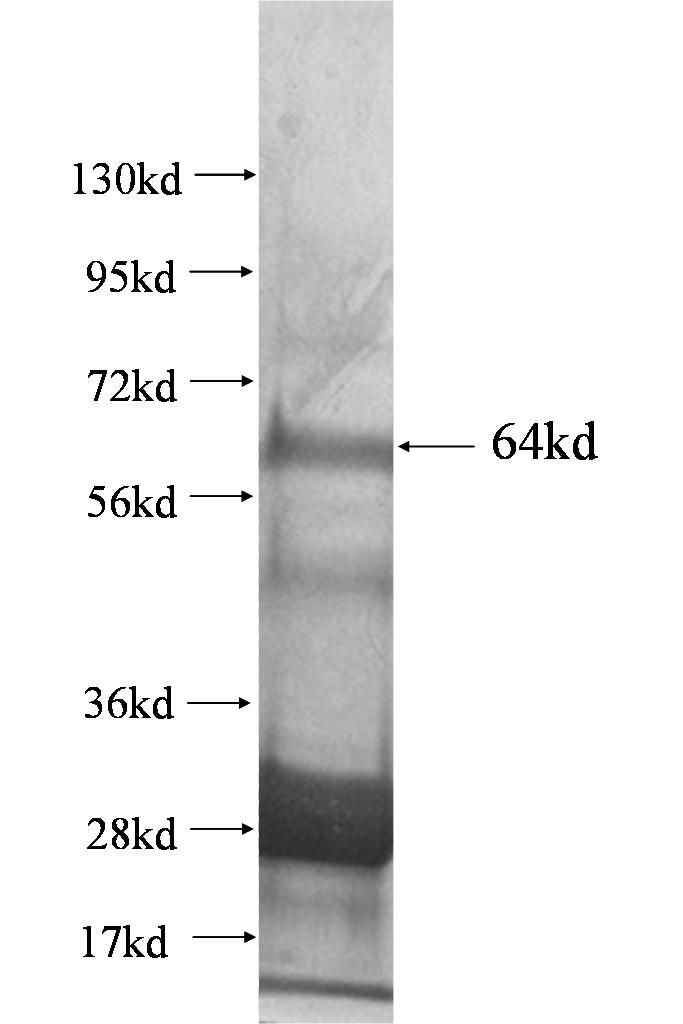 RENALASE fusion protein Ag1323 SDS-PAGE RENALASE fusion protein Ag1323 SDS-PAGE